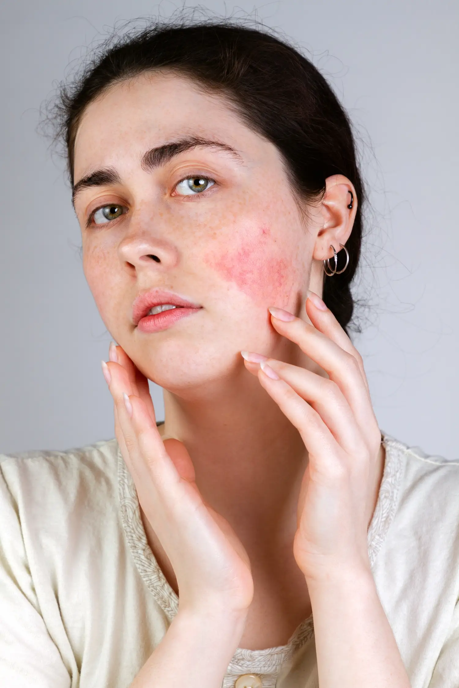 Woman touching her face, highlighting a red patch on her cheek.