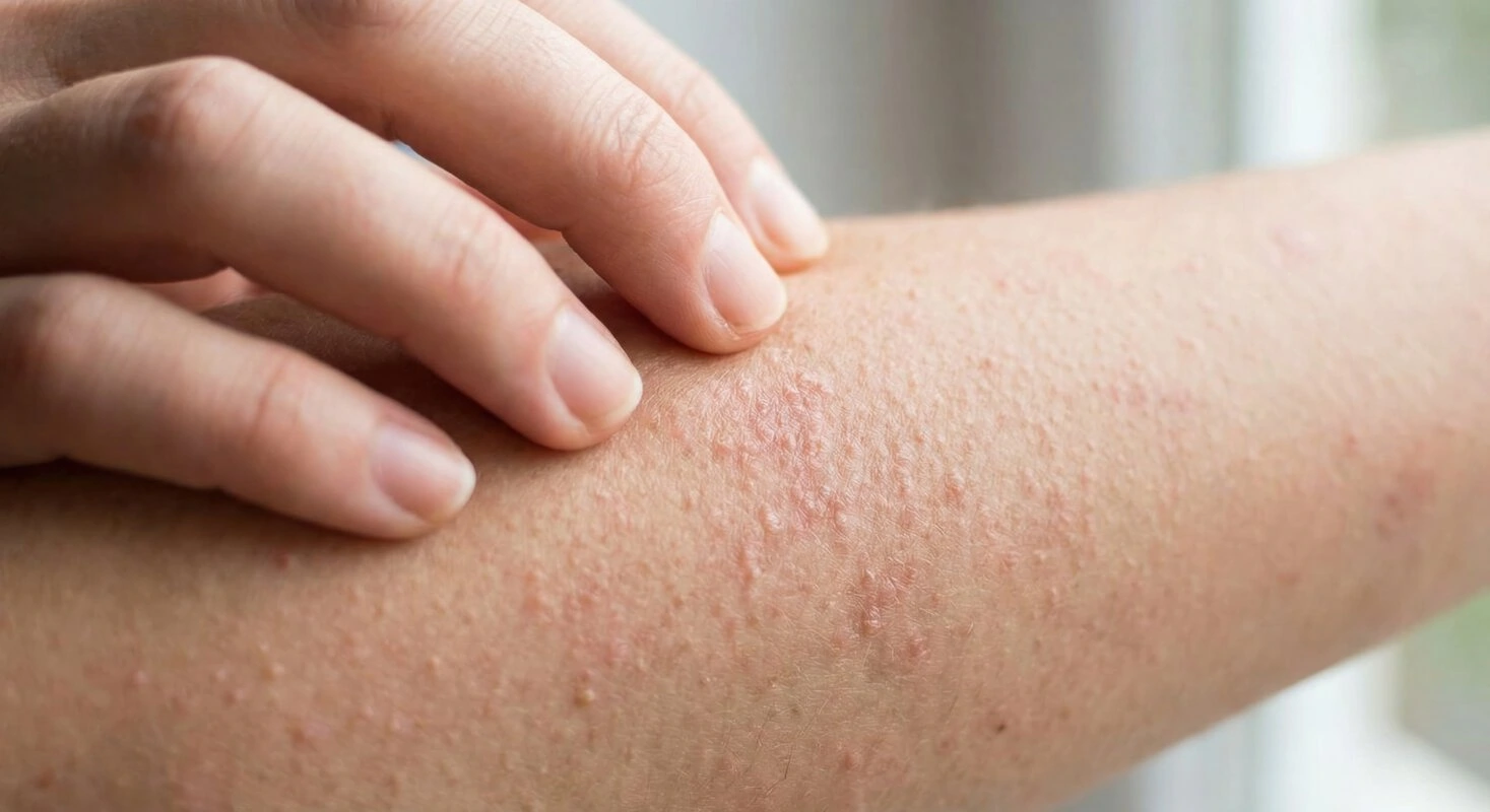 Skin showing symptoms of keratosis pilaris with small bumps and roughness.
