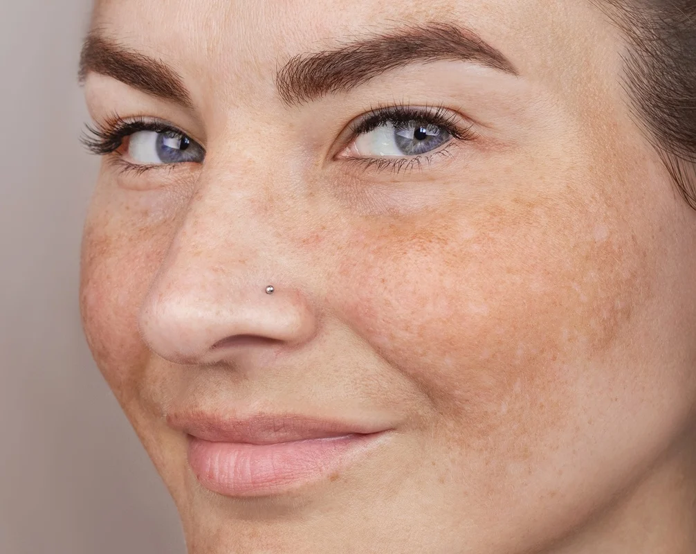 Close-up of a smiling woman's face with freckles and a nose piercing.