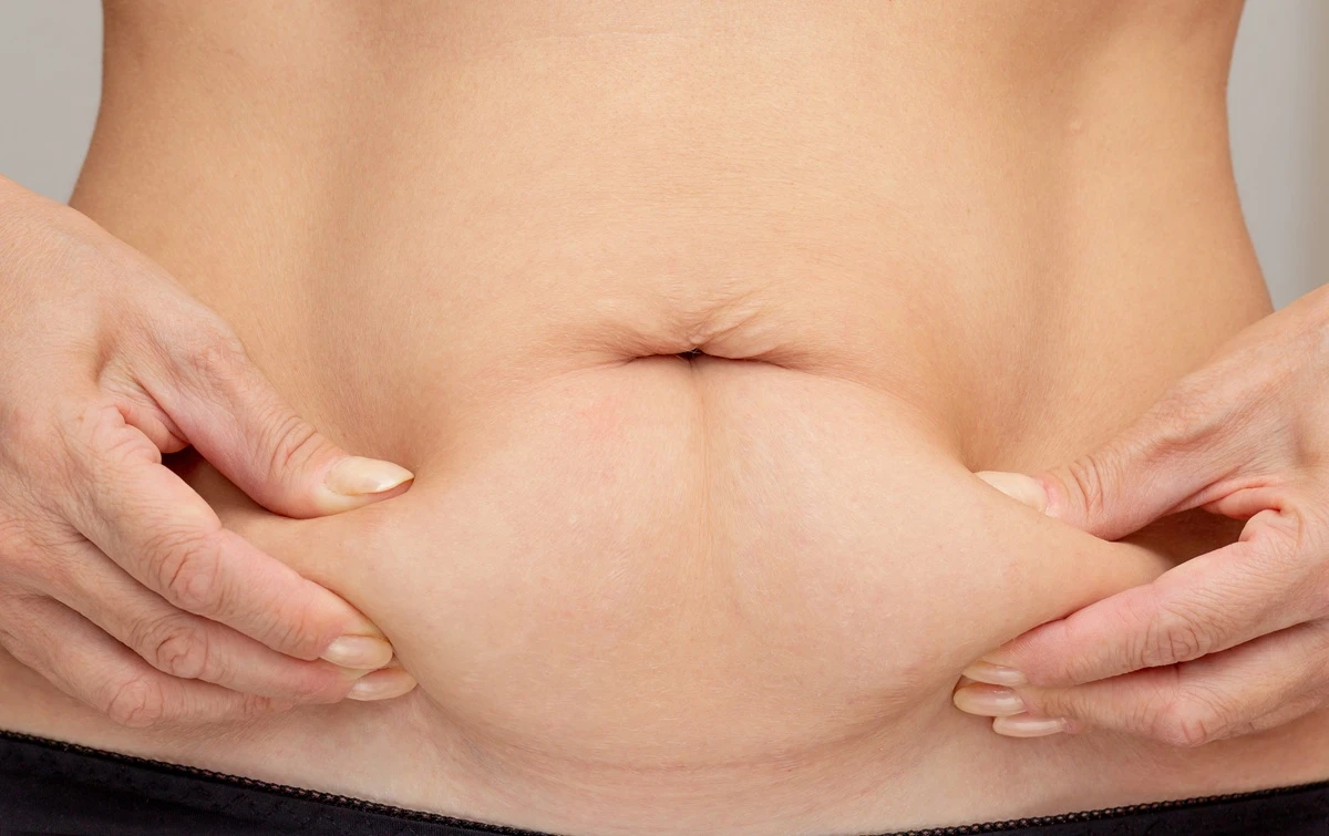 The provided image illustrates an example of skin laxity, where a person is gently pinching the skin on their abdomen, showing the loss of elasticity and sagging commonly associated with this condition.